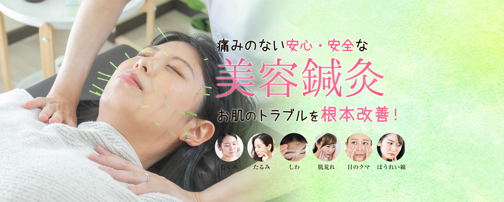 痛みのない安心・安全な美容鍼灸